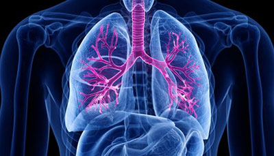 什么是慢性阻塞性肺病 (Chronic Obstructive Pulmonary Disease)，為何與新冠疫情有關(guān)？